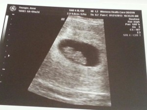ultrasound, 9 weeks, pregnancy, fetus, infant