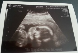 Fetal Ultrasound Face View