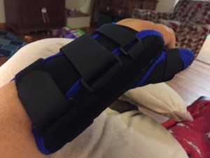 Hand and arm splint